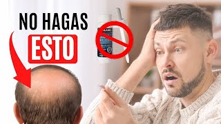 ERRORES al usar MINOXIDIL 🚫 ¡NO LO HAGAS ❌ [upl. by Heti533]