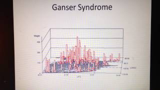 Ganser Syndrome [upl. by Mattias682]