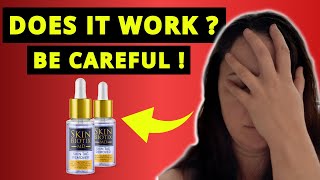 SKIN BIOTIX MD SKIN TAG REMOVER REVIEWS ❌NEW ALERT❌ Skin Biotix Skin Tag Remover Review [upl. by Vacla]