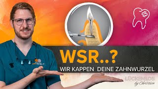 Wurzelspitzenresektion – Was genau erwartet mich [upl. by Bridget]