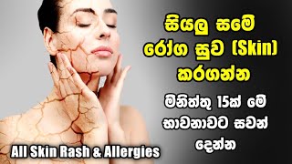 කොච්චර බෙහෙත් කලත් හොද වෙන්නැති ඕනම සමේ රෝගයක් මිතිත්තු 15න් සුව කරන බයිනුරල් භාවනාව [upl. by Hamo]