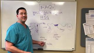 Just the FAQs The HSG Hysterosalpingogram [upl. by Gustave]