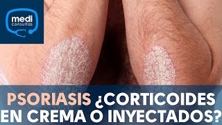 Psoriasis ¿corticoides en crema o inyectados MediConsultas [upl. by Oecam]