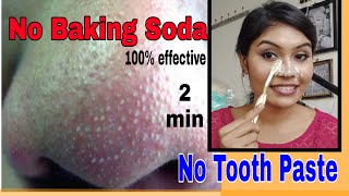 Remove BLACKHEADS  WHITEHEADS at home in just 2 minutes  best amp easy  no baking soda [upl. by Pederson]