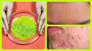 Get clean clear amp flawless skin  remove rashes from face amp body naturally [upl. by Theodoric]