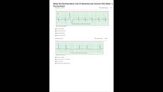 Relias Dysrhythmia Basic Test 35 Questions and Answers 2023 Basic A Dysrhythmia [upl. by Atnima]