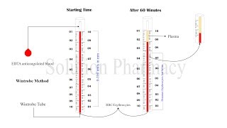 ESR Test  Erythrocyte Sedimentation Rate  ESR Determination  Erythrocyte Sedimentation Test [upl. by Sivel]