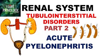 ACUTE PYELONEPHRITIS Pathology [upl. by Florence]