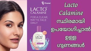 Lacto Calamine Face Lotion  Oil Control Face Cream For Daily Use  Paraben Free Formula [upl. by Trenton]