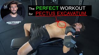 Do THIS WORKOUT to Improve Pectus Excavatum [upl. by Jc]