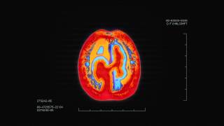 Brain Scan PSA for Alzheimer Society of BC [upl. by Liek]