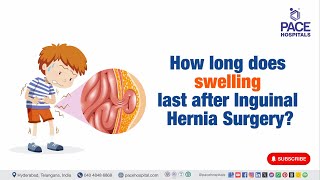 How long does swelling last after Inguinal Hernia Surgery  InguinalHerniaSurgery [upl. by Nealy]