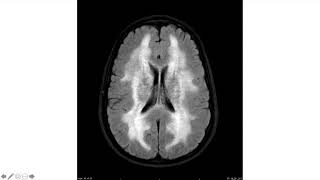 How to add scrollable stack of CT or MRI Images on Microsoft PowerPoint 365 2020  Radiology [upl. by Donelle127]