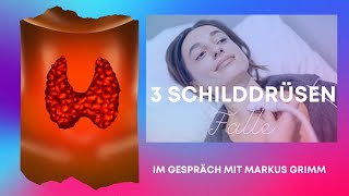 3 Schilddrüsenfälle [upl. by Wier]