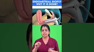 Endometrial biopsy  Why it is done [upl. by Rizzi]