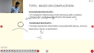 Diverticulitis [upl. by Kassel]