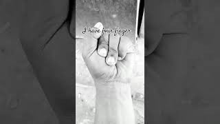 I have four finger [upl. by Azile]