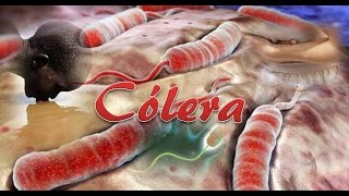 Cólera Vibrio cholerae [upl. by Francoise322]