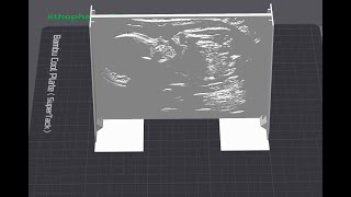 2 Vertically Printed Ultrasound Lithophane [upl. by Babs483]