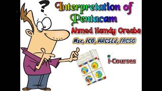 Pentacam Interpretation English [upl. by Merari]