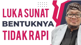 Mengapa Setelah Sunat Bentuknya Kok Tidak Rapi Lukanya [upl. by Arissa]