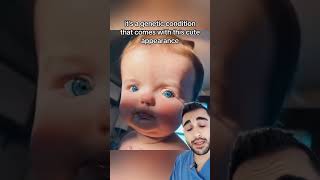 This is Called Waardenburg Syndrome🤯🤯Doctor Reacts [upl. by Brunhilda]