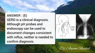 Pediatric MCQs  Infant Vomiting  Differential Diagnosis [upl. by Quita719]