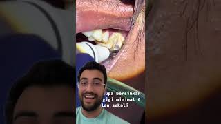 SERÁ QUE TEM UM DENTE EMBAIXO DE TUSO ISSO [upl. by Shien]