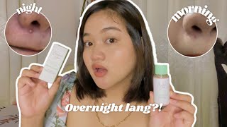 ACNE DRYING LOTION REVIEW  HOW TO USE IT BY CARELINE SKIN✨ [upl. by Daven]