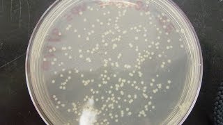 CFU Colony Forming Unit amp cfuml calculation [upl. by Aelsel]