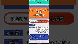 😍スマートウオッチ😍心電図😍AI診断結果😍 [upl. by Lynnea]