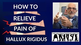 Hallux Rigidus Symptoms Causes and Treatment [upl. by Neehar]