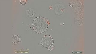 Growth of Mouse Pancreatic Organoids in PancreaCult™ Culture Medium Under a Microscope [upl. by Bithia483]