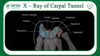 X–Ray of Carpal Tunnel What is Axial Projection Xray Radiographic Patient Positioning [upl. by Eelirol]