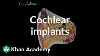 Cochlear implants  Processing the Environment  MCAT  Khan Academy [upl. by Auqenaj519]