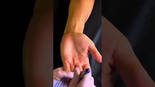 Hand Acupressure  Acupuncture ASMR  always look for the tender points 🤲😴 asmrsounds [upl. by Naiditch]