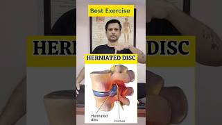 HERNIATED DISC Best Exercises shorts [upl. by Arleta412]