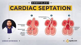 Cardiac Septation  Embryology Video Lecture  USMLE  VLearning Courses [upl. by Seftton191]