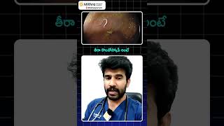 తిన్న వెంటనే మోషన్ వెళ్తున్నారా అయితే ఈ వీడియో చూడండిDrVikranth Chunduri [upl. by Ahsienal176]