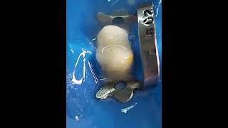 Access Cavity Preparation of Maxillary First Premolar [upl. by Myk353]