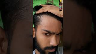 ADIVASI HAIR OIL REVIEW DAY 30 😱 adivasihairoil adivasihairoilreview shorts ytshorts minivlog [upl. by Namilus]