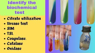 Biochemical Test  Bacterial Identification Technique Microbiology Practical Exam bacteriology [upl. by Publius]