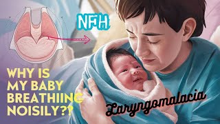 Noisy breathing in babies  Laryngomalacia  Stridor in babies  Baby breathing problems [upl. by Jannery]