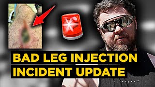 I almost had to amputate my leg LEG INJECTION HORROR STORY During pfspssdpasplms Recovery [upl. by Balf181]