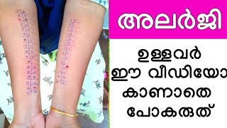 Allergy Skin TestAllergy test skin prickഅലർജി പെട്ടെന്ന് സുഖപെടുത്താം How to allergy testing [upl. by Rehpatsirhc935]