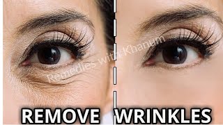 Best Home Remedies For Wrinkles  AntiAging OIL amp Drink for Skin Tightening 100 Effective [upl. by Assirod325]