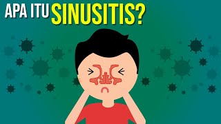 Apa itu Sinusitis [upl. by Itnavart]