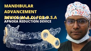 Dr Rudra Mohan  Mandibular Advancement Device for Obstructive Sleep Apnoea and Reduction in Snoring [upl. by Englis]