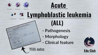 ALL Acute Lymphoblastic LeukemiaLymphoma  Disorders of White Cells  Lymphoid neoplasm Pathology [upl. by Mirielle]