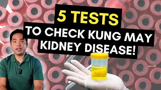 5 Tests Para Malaman Kung May Kidney Disease [upl. by Bonne]